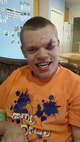 The next day. He doesn't seem to be suffering...