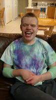 Stitches are out!
